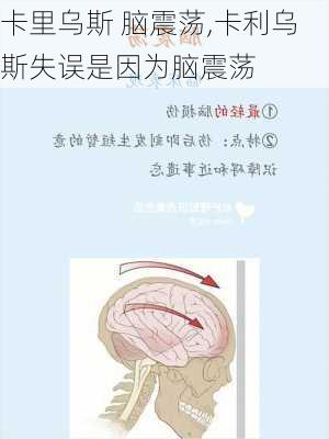 卡里乌斯 脑震荡,卡利乌斯失误是因为脑震荡